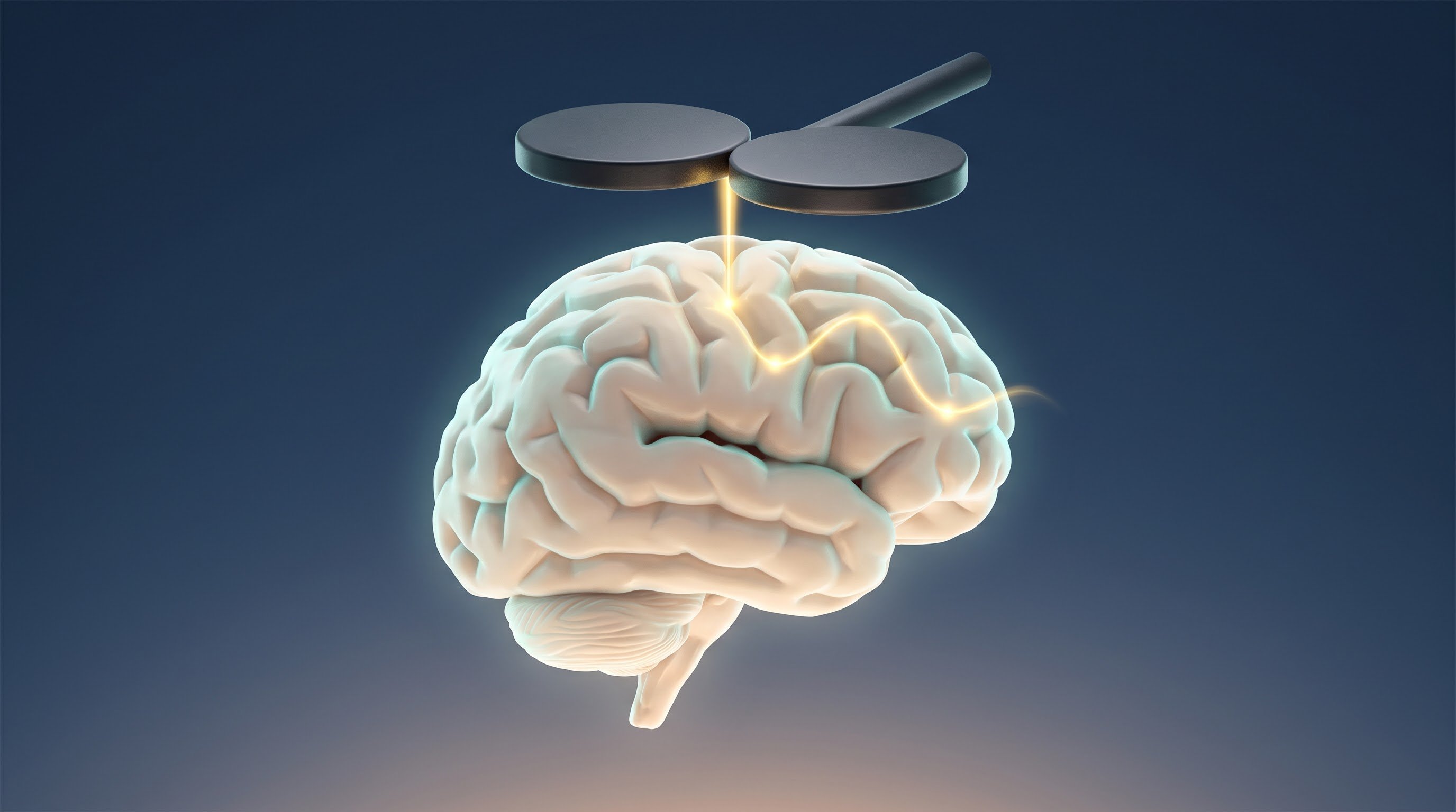 Side view of a pearl-white brain against a dark blue background. Above it floats a flat coil of two dark discs with a handle; a golden beam of light enters the brain and runs as a wavy line across the front.
